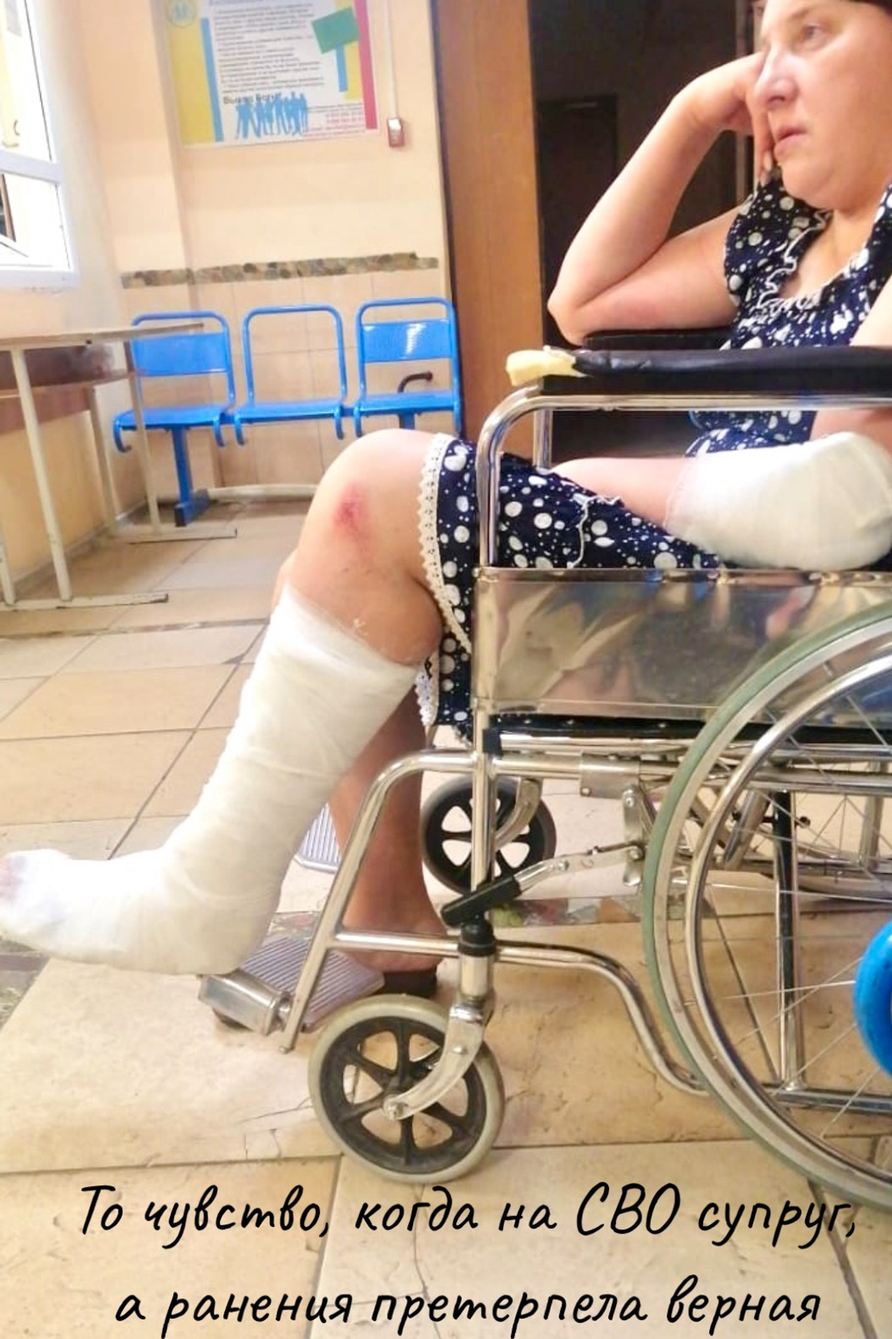 У Наташи три перелома. Вернов Продюксьон & АККА Мьюзик в ассоциации CASIDAF & BRUCEF