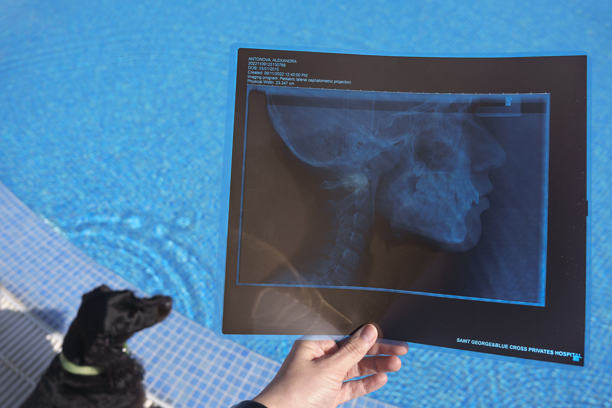 Cyprus diary (in work). Ant | photo