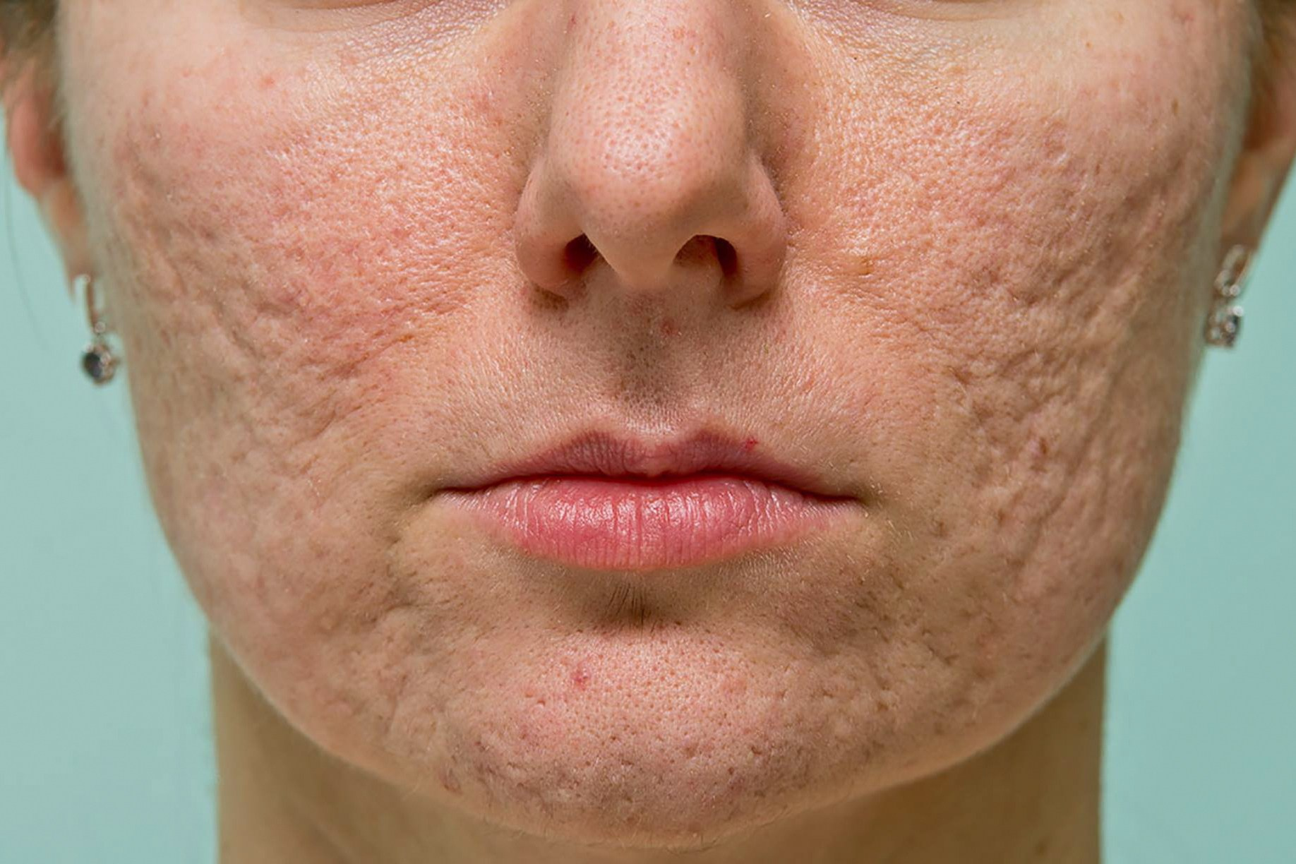 A Deep Dive Into The Professional Model Photographer’s Journey & Inspiration. Mark Smilyanic | Portretni boudoir fotograf iz Beograda