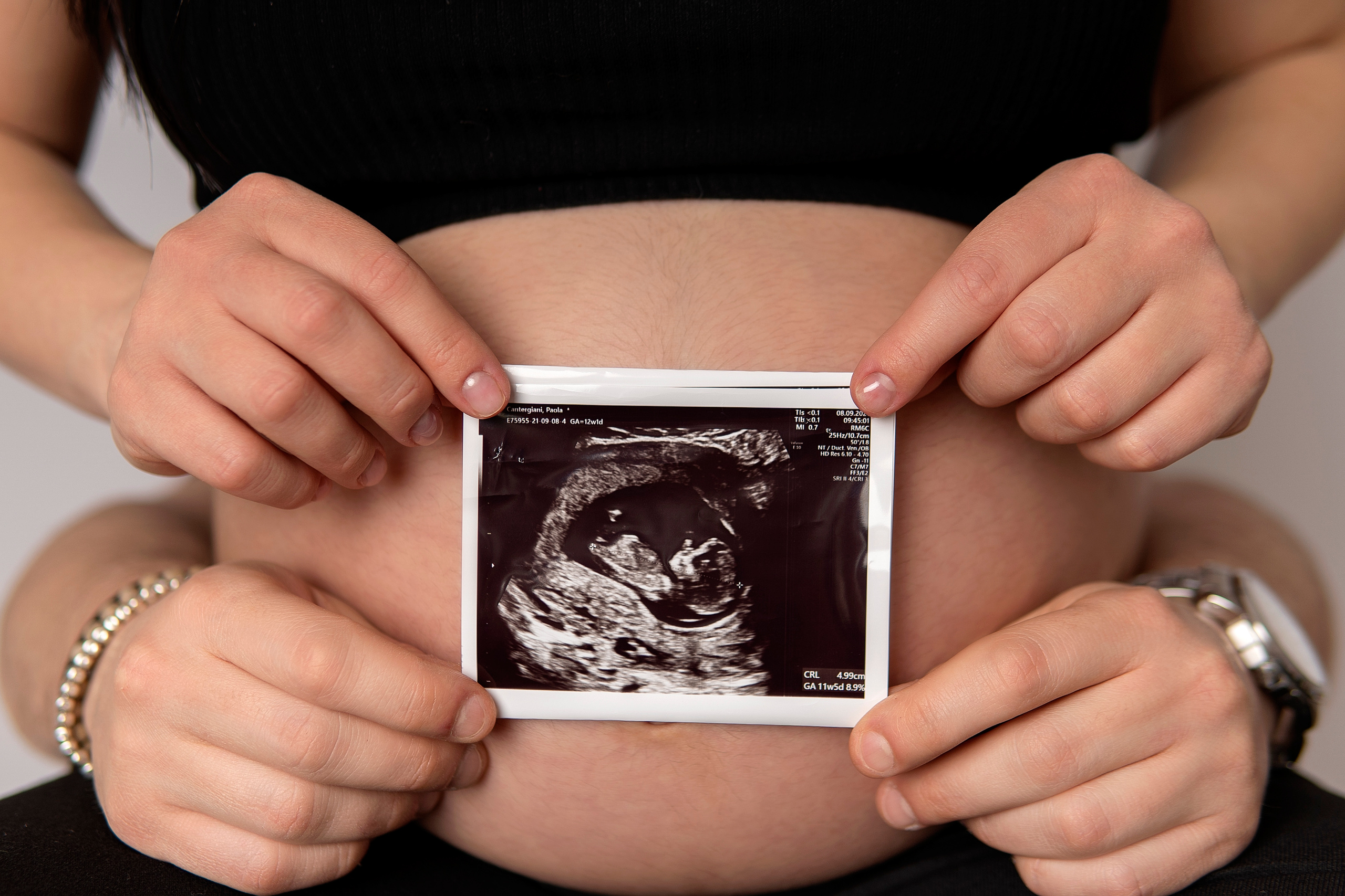 Gravidanza. Mylittlenewbornphotography