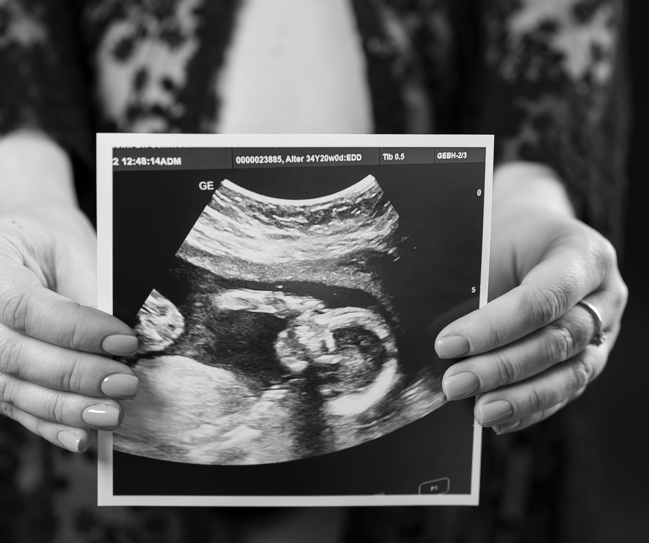 Студийная съёмка беременность. Семейный, детский и женский фотограф в Германии, Трире