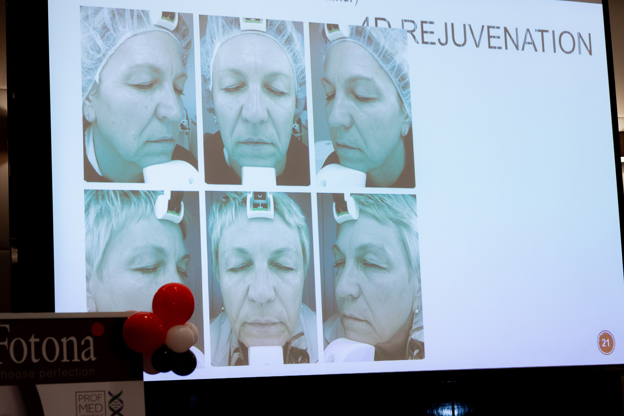 Fotona presentation. MATVEEVA STUDIO