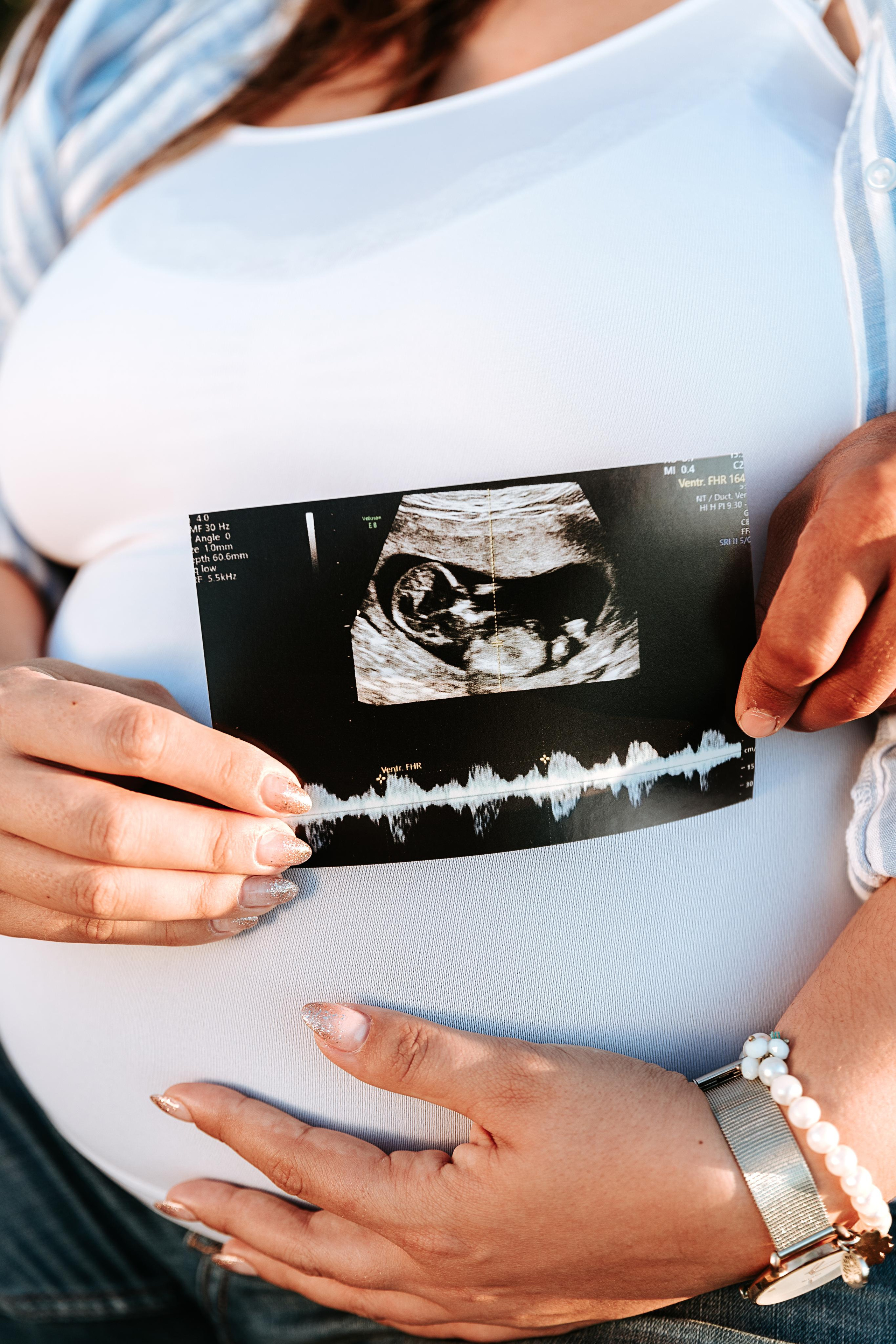 Sessão Maternidade. Luxury Wedding Photography & Cinematic Films | Portugal & Destination Weddings | Ricardo & Mary Pictures