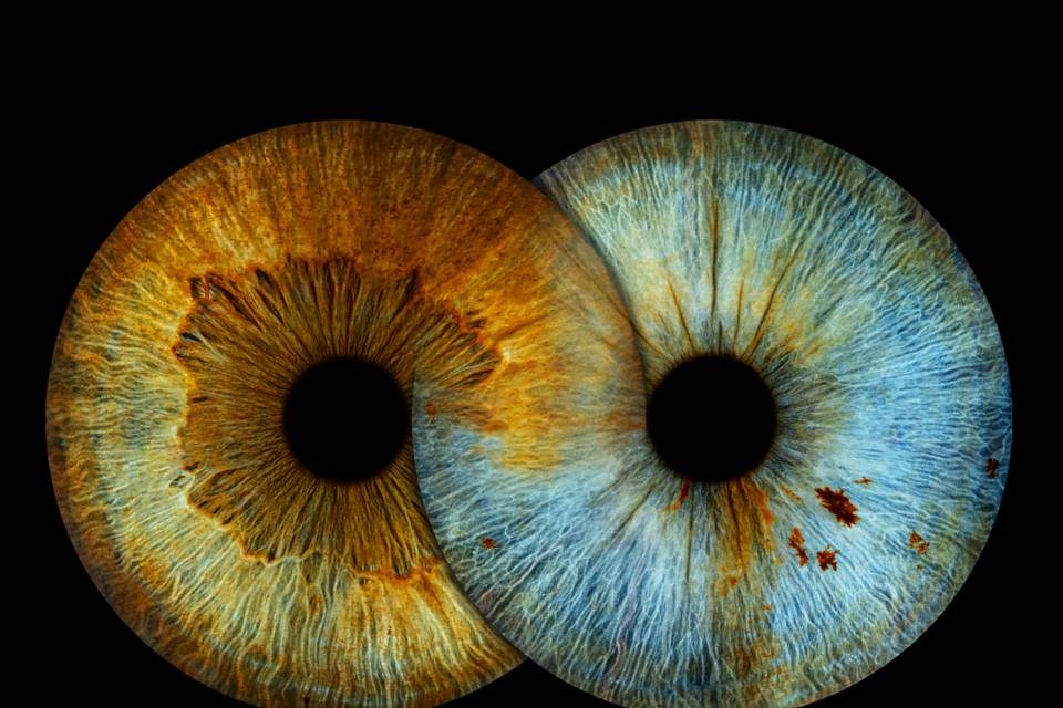 Hi, my name is Eric T and I am Iris photographer